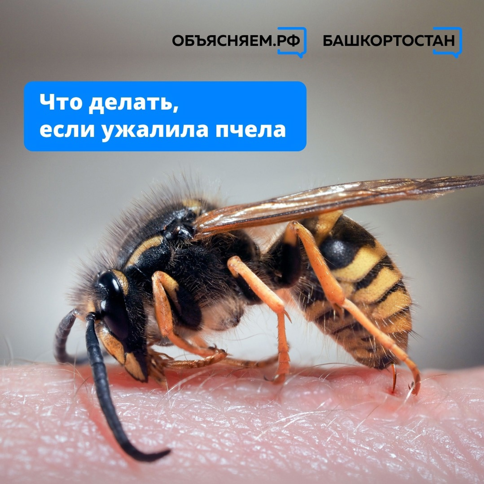 Что делать если ужалила пчела