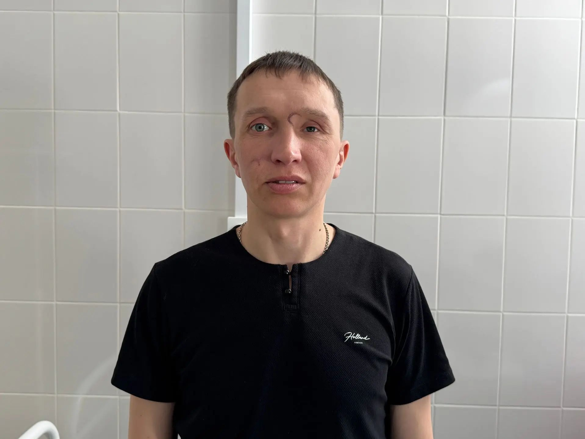 В Башкортостане ветерану СВО сделали несколько пластических операций.