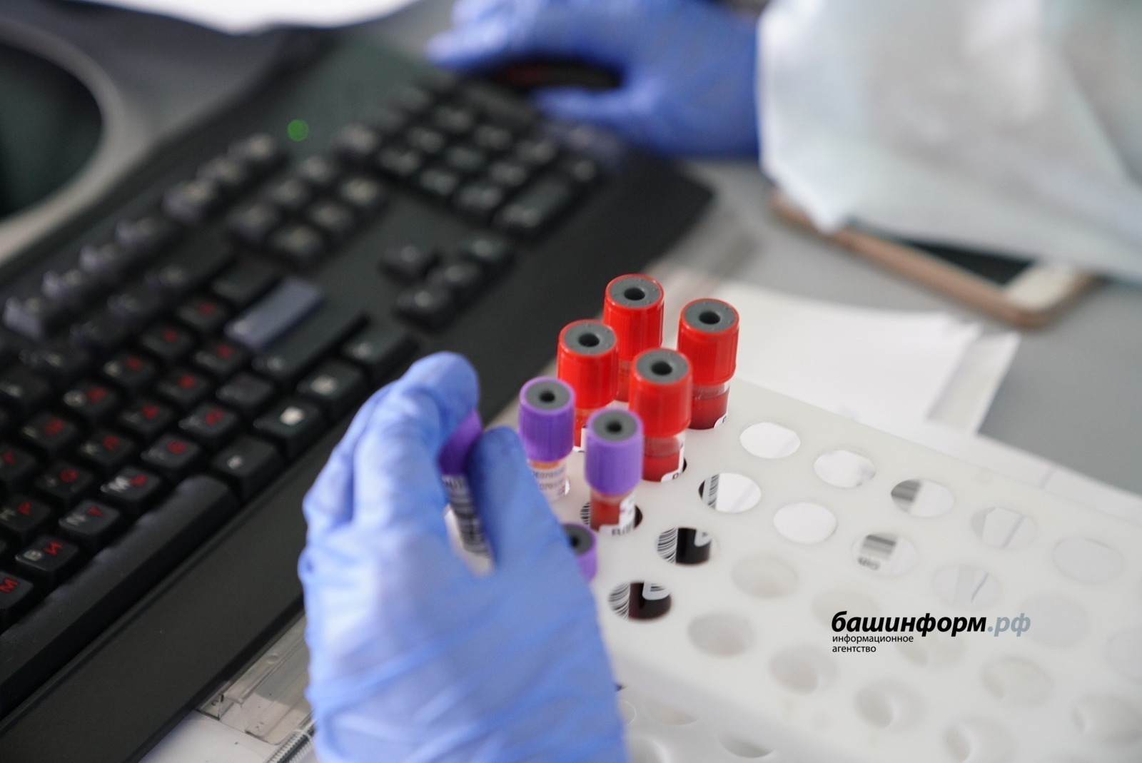 В Башкирии зафиксированы три случая заражения бешенством